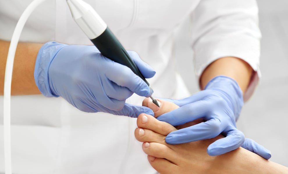 VCF medisch pedicure